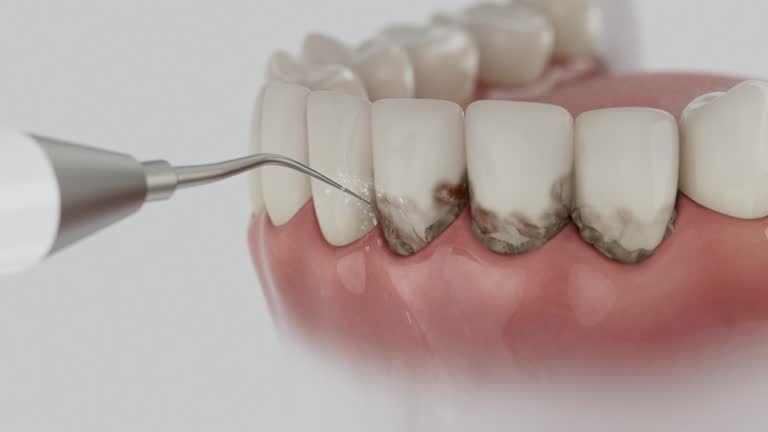 Reliable Dental Implants contractor in Buford, GA by Smile Center Dentistry